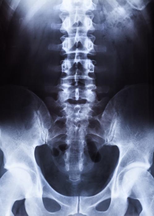 [X-ray spine and pelvis]